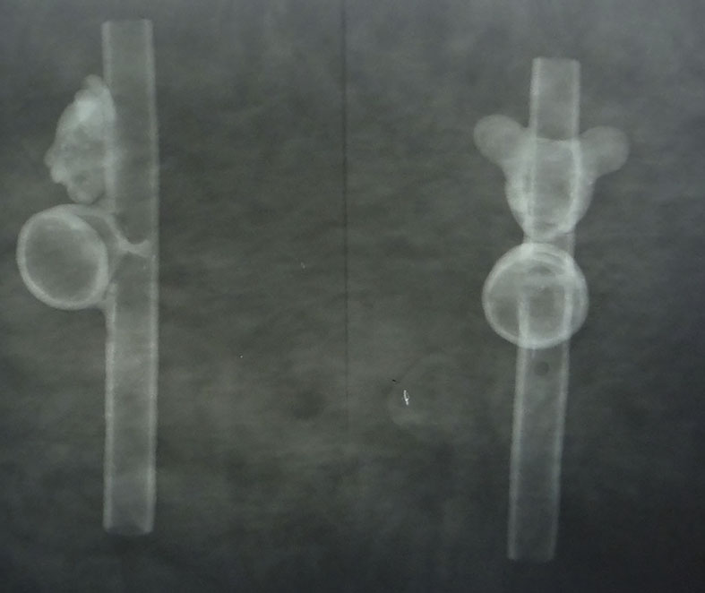 Figura 25. Radiografía tomada por Dra. Josefina Bautista, Museo Nacional de Antropología.